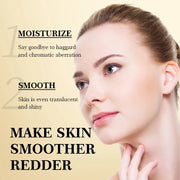 Powerful Freckle Removal Cream | Anti-Pigmentation & Melasma Corrector