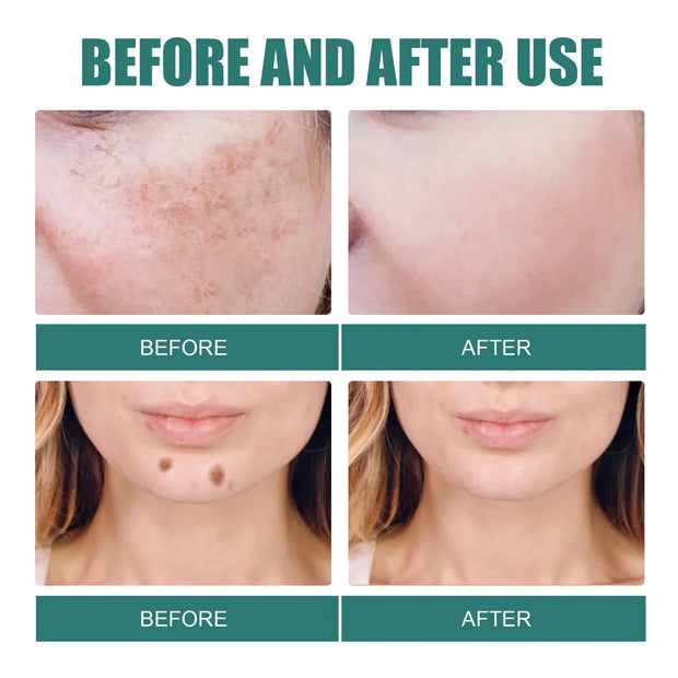 Powerful Herb Whitening Freckle Cream