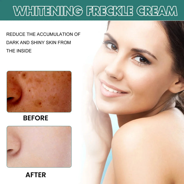 Powerful Herb Whitening Freckle Cream