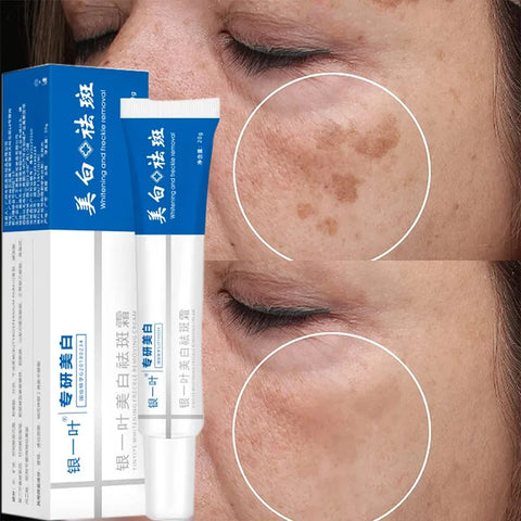 Effective Whitening Freckle Face Cream Remove Dark Melanin Improve Dullness Skin Care