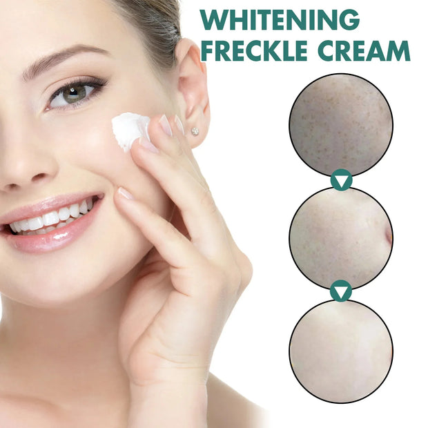 Powerful Herb Whitening Freckle Cream