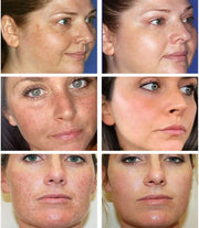 Effective Whitening Freckle Face Cream Remove Dark Melanin Improve Dullness Skin Care