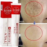 Powerful Freckle Removal Cream