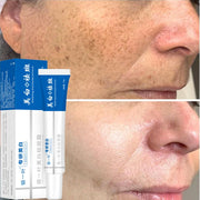 Effective Whitening Freckle Face Cream Remove Dark Melanin Improve Dullness Skin Care