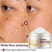 Rice Anti-Wrinkle Facial Cream | Acne, Melasma & Pigmentation Treatment | 30g Korean Beauty