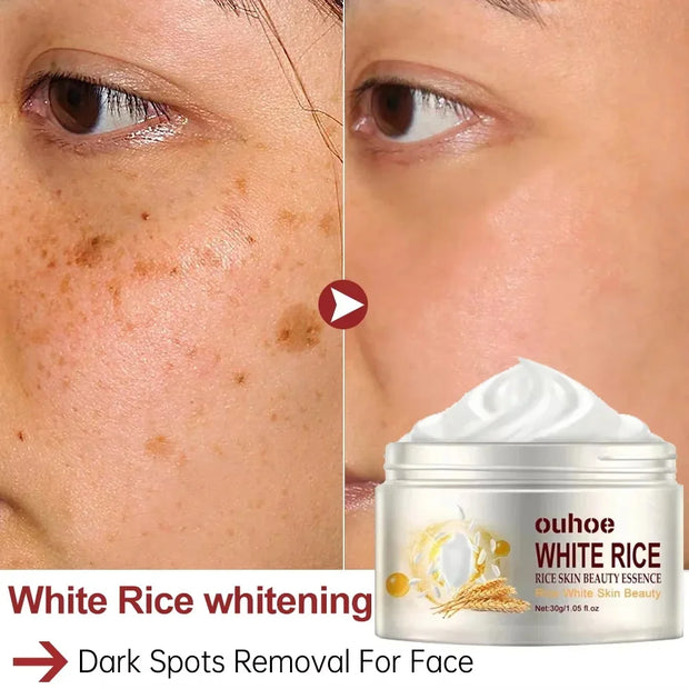 Rice Anti-Wrinkle Facial Cream | Acne, Melasma & Pigmentation Treatment | 30g Korean Beauty