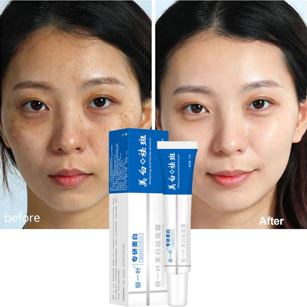 Effective Whitening Freckle Face Cream Remove Dark Melanin Improve Dullness Skin Care