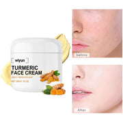 Turmeric Whitening Anti-Wrinkle Facial Cream | Brighten Skin & Remove Dark Spots