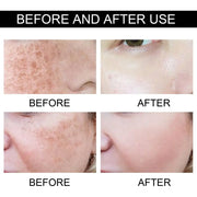 Face Brightening Cream - Fade Black Spots & Revitalize Your Skin