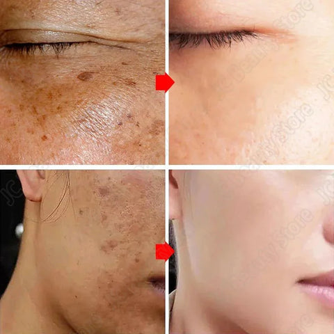 Powerful Herb Whitening Freckle Cream