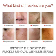 Powerful Herb Whitening Freckle Cream