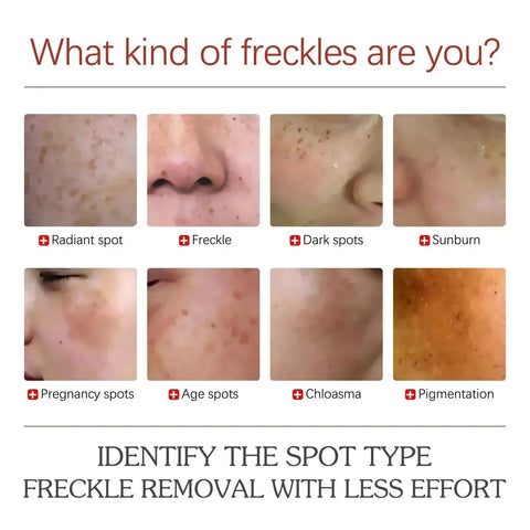 Powerful Herb Whitening Freckle Cream