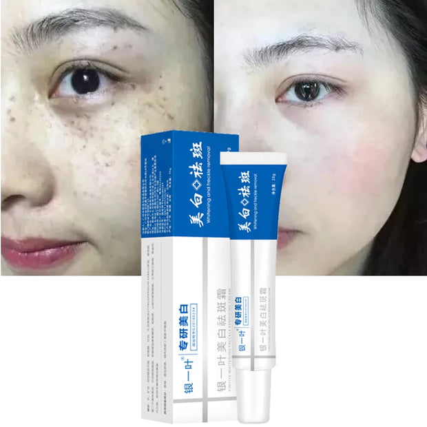 Effective Whitening Freckle Face Cream Remove Dark Melanin Improve Dullness Skin Care