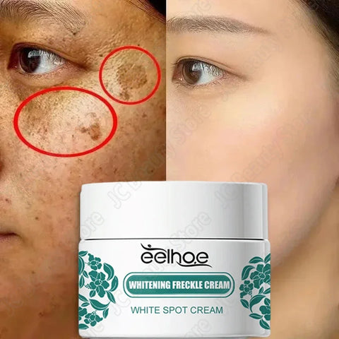 Powerful Herb Whitening Freckle Cream