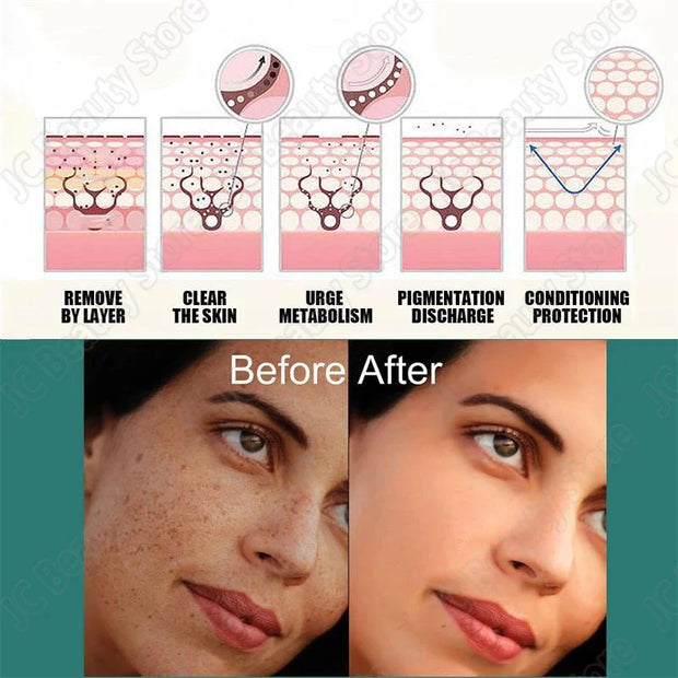 Powerful Herb Whitening Freckle Cream